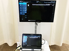 超音波画像観察装置を使用した検査1